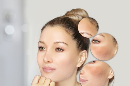 Siempre que puedas, busca sombra o usa un sombrero de ala ancha para proteger tu rostro.