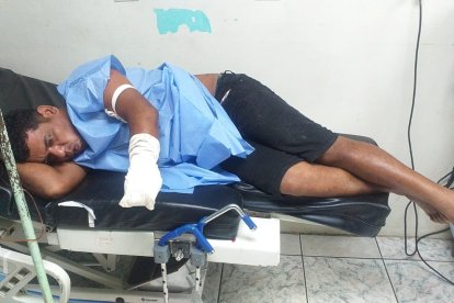 El hombre se quedó sin una mano pero no denunciará a su amigo.