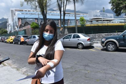 Gabriela Álvaro muestra las marcas  que le deja en su brazo el tratamiento de diálisis.