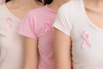 El cáncer de mama es el tipo de tumor más diagnosticado en mujeres a nivel mundial.