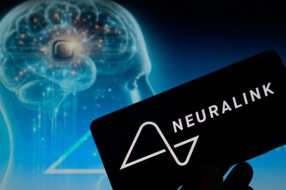 La interfaz cerebro-computadora desarrollada por Neuralink podría reemplazar funciones de los teléfonos móviles.
