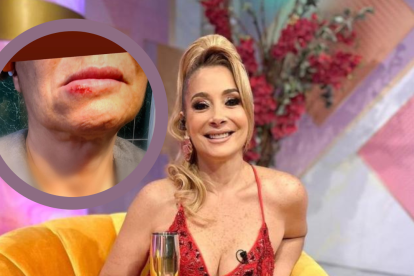 Marián Sabaté sufrió accidente este 20 de abril de 2025