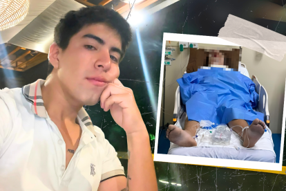 Israel permanece en coma inducido, en la unidad de quemados de un hospital de Guayaquil.