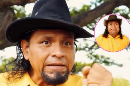 Miguel Santana sufrió la amputación de su pie izquierdo.