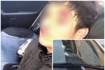 El implicado fue detenido. Un patrullero quedó con daños.