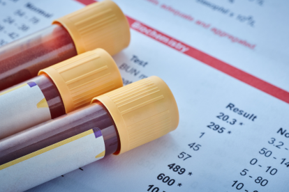 La prevención comienza con un análisis.