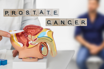 El cáncer de próstata, una enfermedad silenciosa que puede ser vencida con prevención y diagnóstico oportuno.
