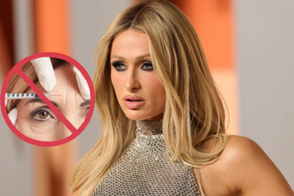 La empresaria y madre Paris Hilton revela que nunca ha recurrido al botox ni rellenos.