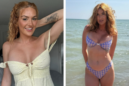 Annie Charlotte ha expresado que su extraña condición le da grandes ingresos en la plataforma OnlyFans.