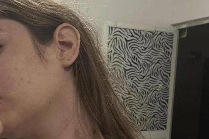 La chonense Nicolle Aray señala a su pareja como responsable de un caso de maltrato y violencia