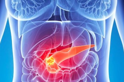 La terapia combinada logró eliminar el tumor en ratones sin generar efectos secundarios adversos.