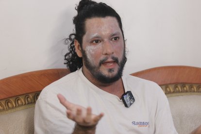 Felipe Crespo revela cómo la dermatitis y un accidente cambiaron su vida