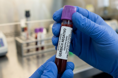 Este avance científico es considerado un hito para la seguridad transfusional y la medicina obstétrica en el país