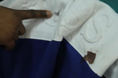 Un agujero y una mancha de sangre quedaron en el buzo que llevaba puesto el menor de edad.