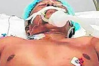 El afectado por el accidente de tránsito en Santa Elena, permanece hospitalizado en una casa de Salud de Guauaquil.