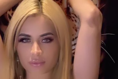 Anita tiene 12 cirugías en su cuerpo.