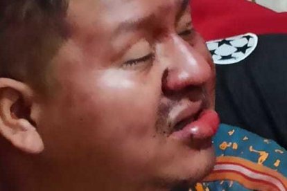 En estas condiciones lo encontraron sus familiares el pasado 18 de julio.