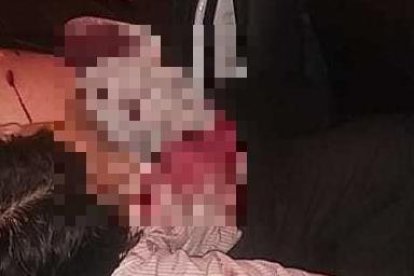 El hombre fue atacado cuando intentó enfrentarse a los delincuentes.