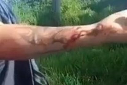 El agredido mostró su herida en un video que lo difundió en redes.