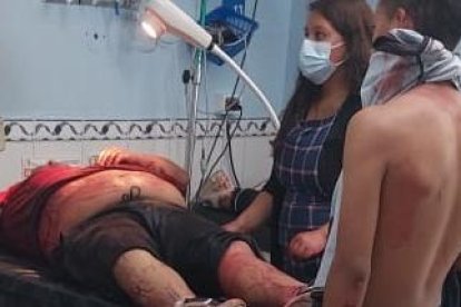 El hombre se recupera luego de un ataque con cuchillo que sufrieron él y su amigo.