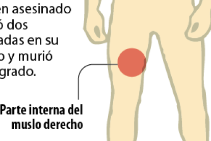 Las heridas que provocaron su muerte.