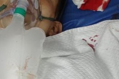 El policía se encuentra con pronóstico reservado en el Hospital Eugenio Espejo.