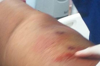 Una de las víctimas fue Elvis Gracia, quien recibió varios impactos de bala.