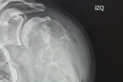 Detalle de la radiografía.