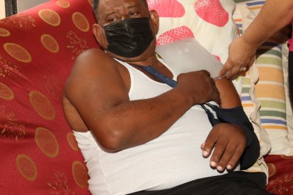 El tumor ha hecho que su brazo se hinche íntegramente, desde su mano hasta la tetilla, esta última parte de su cuerpo estaba tan grande que parecía un seno.