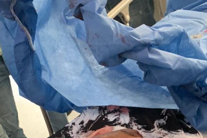 Este es el cuerpo de uno de los baleados en la  jornada criminal.