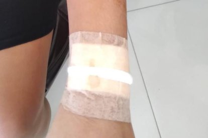 El brazo izquierdo de la víctima fue el más afectado, junto con su cuello y cadera.
