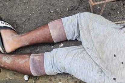 Este fue el último ataque a una persona. Sucedió en el barrio La Cananga.