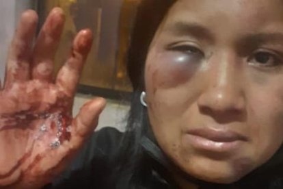 Esta es la foto de la última agresión que la víctima recibió. Ahora ella está muerta.