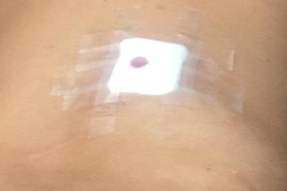 Los médicos intervinieron oportunamente a la víctima del ataque.