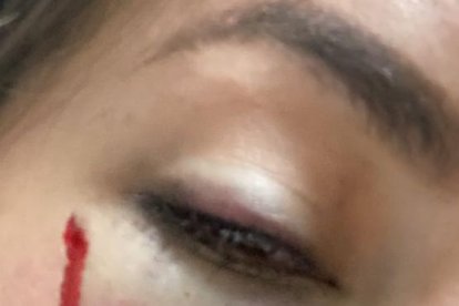 El agresor la golpeó con la base de un arma de fuego.