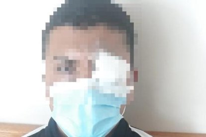 El cabo se salvó de perder el ojo por la protección que llevaba puesta.