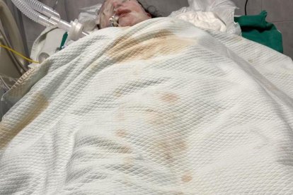 La joven está en el área de Cuidados Intensivos.