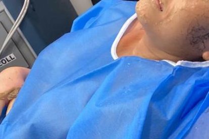 La mujer iba a ser operada, pero los médicos vieron una mejoría.