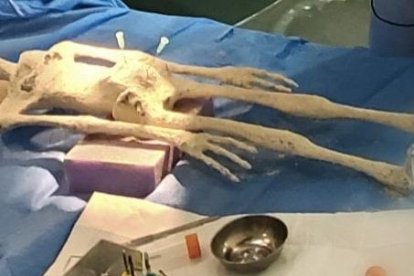 El ADN practicado no coincide con el humano. Tiene similitud en un 17% con la estructura de un frijol.