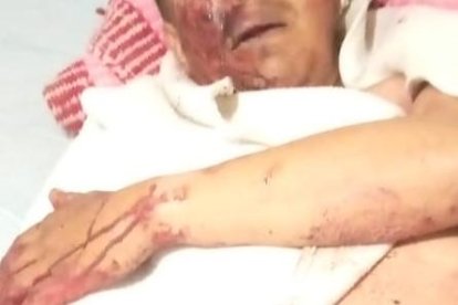 El afectado fue llevado hasta una casa de salud, donde lo estabilizaron.