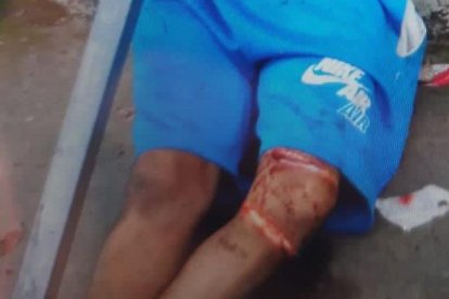 El cuerpo fue abandonado luego de que los criminales lo machetearon.