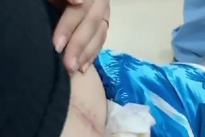 La menor de edad  se deprime cuando observa la herida que tiene en su abdomen.