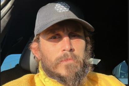 Así luce Chito, a 9 días de la pelea ante O'Malley.