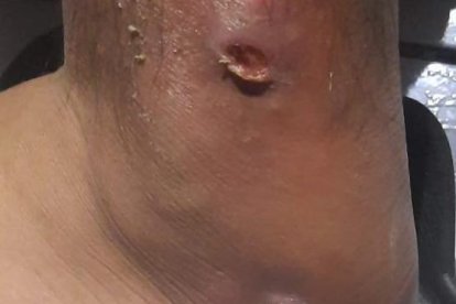 Así lucen las heridas del chico. Se abren a cada momento y supuran. Sería por culpa de una brujería.