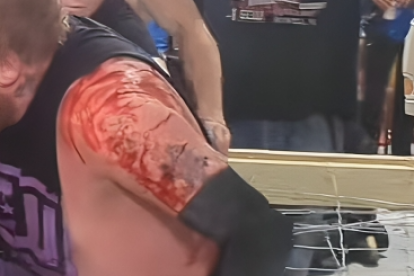 Escena de uno de los combates donde un luchador se levanta luego de ser tirado en alambres de púa.