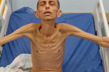 Xavier Gustavo G. T., quien fue ingresado en estado crítico debido a un severo cuadro de desnutrición.