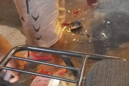 Un hombre fue alcanzado por las balas en Atacames.