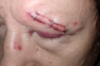 Rolando García fue golpeado en la cara.