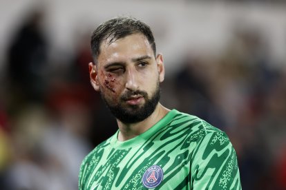 El rostro de Gianluigi Donnarumma tuvo que ser saturado, tras el impacto de los pupos de Singo