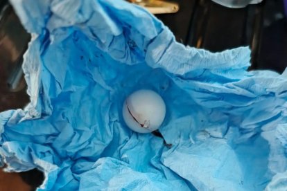 Evidencia mostrada por los galenos en el hospital que muestran el perdigón encontrado en la cavidad en lugar del ojo.